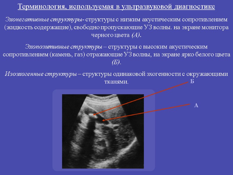 Эхонегативные структуры- структуры с низким акустическим сопротивлением (жидкость содержащие), свободно пропускающие УЗ волны. на